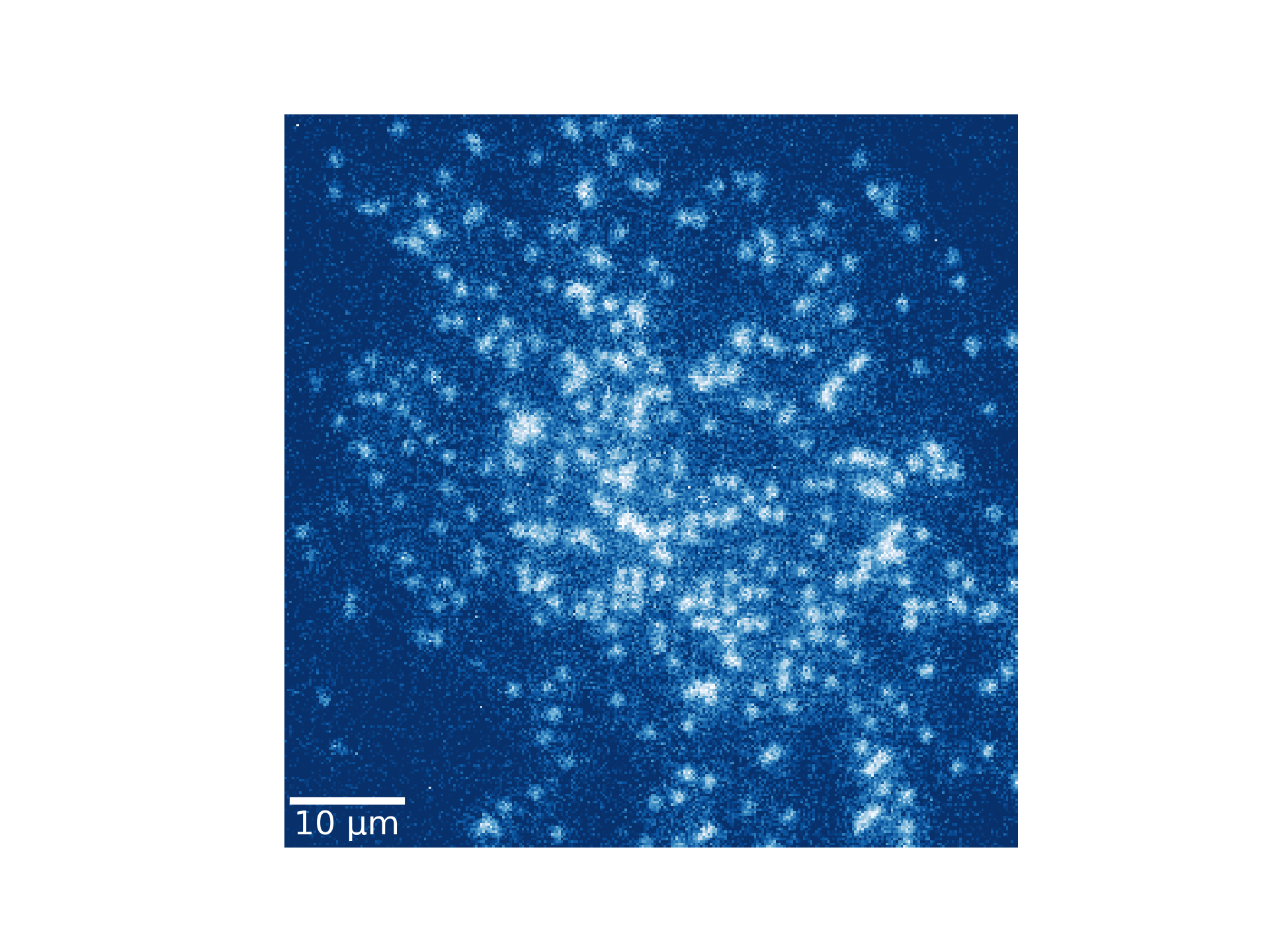 Single Cs atoms detected in our quantum gas microscope